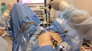 Фото:лапароскопия маточных труб для чего